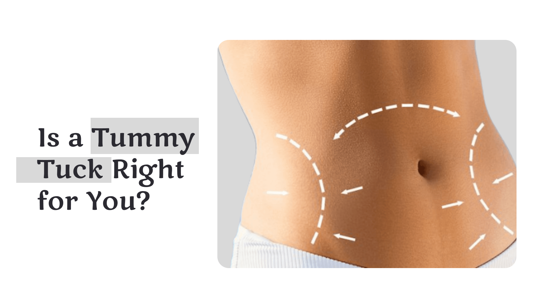 Is a Tummy Tuck Right for You?